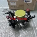 Cụm bướm ga Hyundai Avante