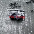 Cảm biến khoảng cách Hyundai Elantra